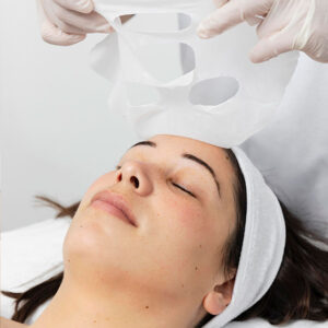 Peeling Químico / Peeling Inteligente