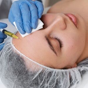 Bioestimuladores de Colágeno