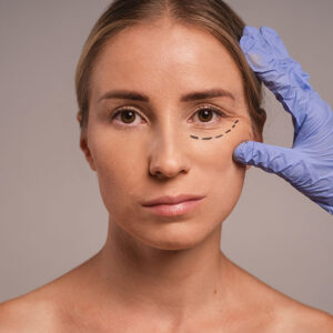 Hilos PDO de Polidioxanona