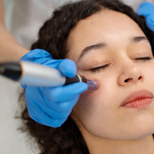 Plasmapen / Fibroblast