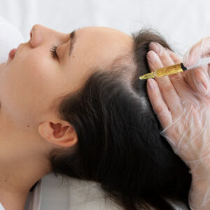 Tratamientos Capilares