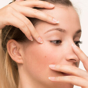 Tratamientos Despigmentantes