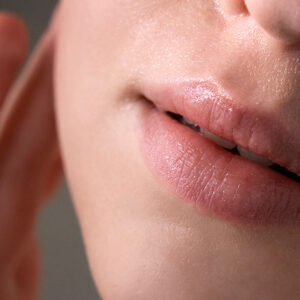 Volumización e Hidratación de Labios con Ácido Hialurónico
