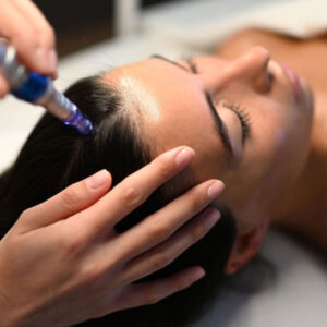 Tratamiento con microagujas para la caída capilar